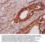 PTPN3 Antibody