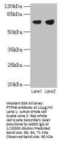 PTPN6 Antibody