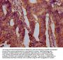 PTPN9 Antibody