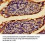 PTPRF Antibody
