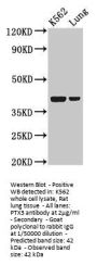 PTX3 Antibody