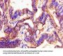 PTX3 Antibody