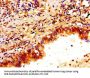 PTX3 Antibody
