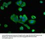 PTX3 Antibody