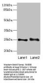 RAB3B Antibody