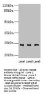 RAB4B Antibody