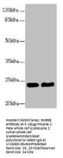 RAB5B Antibody