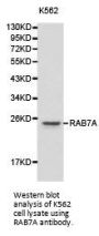 RAB7A Antibody