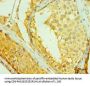 RAD1 Antibody