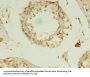 RANBP2 Antibody