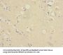 RAP2B Antibody