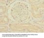 RAP2B Antibody