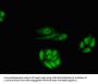 RARB Antibody