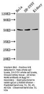 RARG Antibody