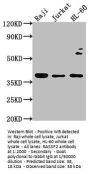 RASSF2 Antibody