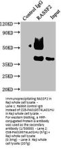 RASSF2 Antibody