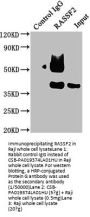 RASSF2 Antibody