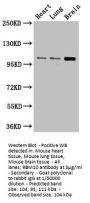 RBM10 Antibody