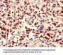 RBM10 Antibody