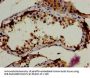 RBP1 Antibody