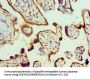 RBX1 Antibody