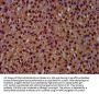 RECQL4 Antibody