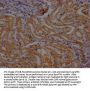 Ren1 Antibody