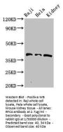 RFC4 Antibody