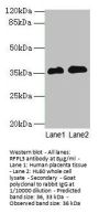RFPL3 Antibody