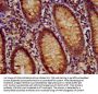 RFX1 Antibody