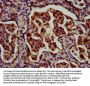 RFX1 Antibody