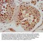 RFX2 Antibody