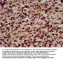 RFX2 Antibody