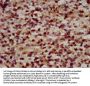 RFX2 Antibody