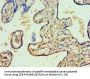 RFX5 Antibody