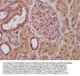 RFXANK Antibody