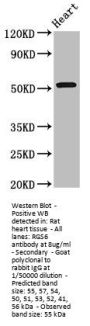 RGS6 Antibody