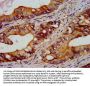RGS6 Antibody