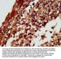 RGS6 Antibody