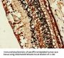 RLBP1 Antibody