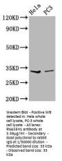RNASEH1 Antibody