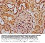 RNASEH1 Antibody