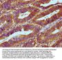 RNASEH1 Antibody