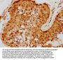 RNASEH2A Antibody