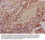 RNF122 Antibody