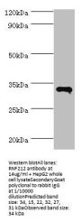 RNF212 Antibody