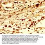 RNF219 Antibody