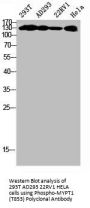 Phospho-PPP1R12A (T853) Antibody