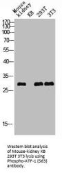 Phospho-ATF1 (S63) Antibody