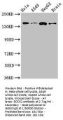 ROCK2 Antibody